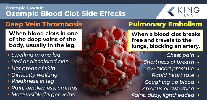 This infographic explains what deep vein thrombosis is and it's side effects, and what pulmonary embolism is and it's side effects. 3D render of a blood clot in a vein.