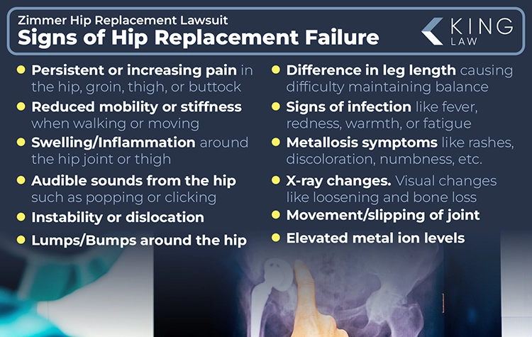 This infographic lists the signs of hip replacement failure. Image of a doctor examining an x-ray of a human pelvis with a hip replacement.