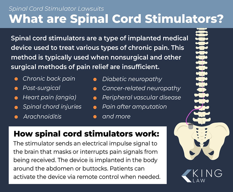 Infographic explaining what spinal cord stimulators are, what they are used for, and how they work. Illustration of a spine and hip bone with an internal spinal cord stimulator.