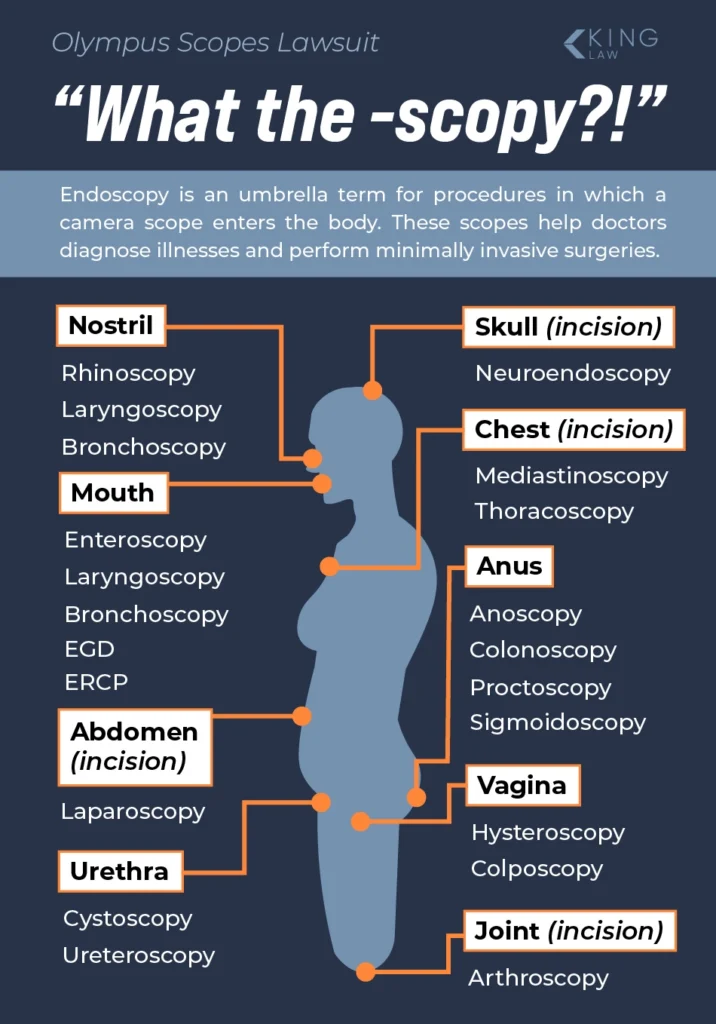 Infographic showing a list of endoscopy procedures based on where the scope is entered in the body.