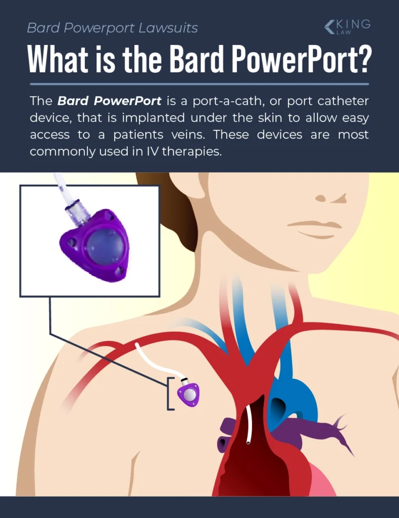 Graphic of the approximate location of a Bard PowerPort in the body and an explaination of what it is. 