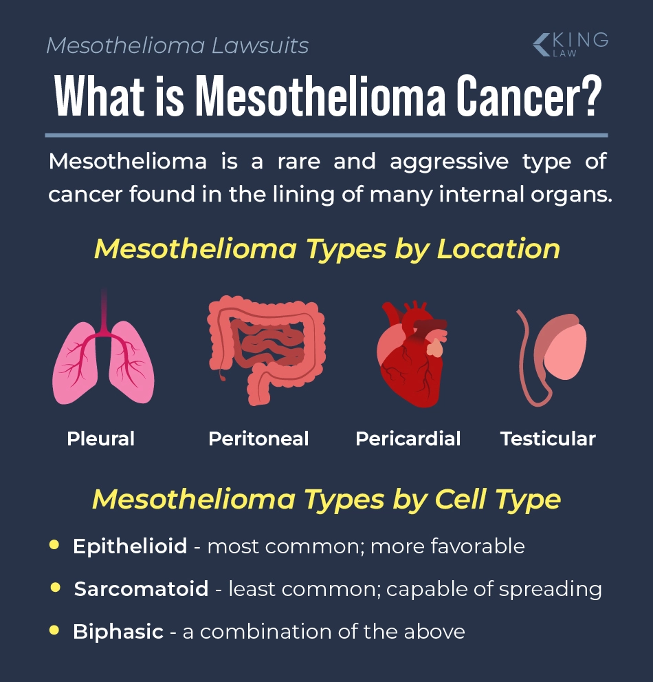 Infographic explaining what mesothelioma is, and lists the different types of mesothelioma.