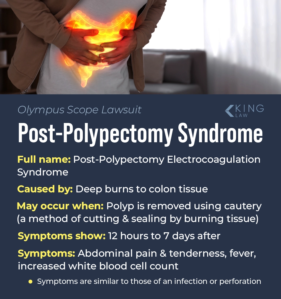 Overview of what post-polypectomy syndrom is.